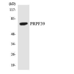 Western blot analysis of the lysates from COLO205 cells using Anti-PRPF39 Antibody