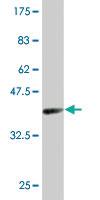 Anti-SPI1 Mouse Monoclonal Antibody [clone: 2G1]