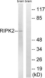 Western blot analysis of lysates from rat brain cells using Anti-RIPK2 Antibody. The right hand lane represents a negative control, where the antibody is blocked by the immunising peptide