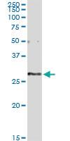 Anti-EXOSC5 Polyclonal Antibody Pair