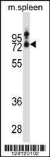 Anti-SLC15A3 Rabbit Polyclonal Antibody (AP (Alkaline Phosphatase))