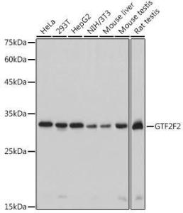 Western blot analysis of extracts of various cell lines, using Anti-GTF2F2 Antibody [ARC2513] (A306881) at 1:1,000 dilution