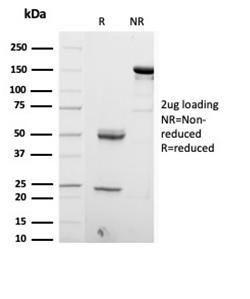 SDS-PAGE analysis of Anti-S100 beta Antibody [S100B/4153] under non-reduced and reduced conditions; showing intact IgG and intact heavy and light chains, respectively. SDS-PAGE analysis confirms the integrity and purity of the Antibody