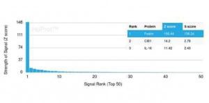 Analysis of protein array containing more than 19000 full-length human proteins using Anti-alpha II Spectrin Antibody [SPTAN1/3505]