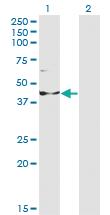 Anti-INPP1 Mouse Monoclonal Antibody [clone: 1A6]