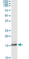 Anti-RLN1 Antibody Pair