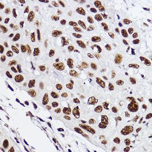 Immunohistochemistry analysis of paraffin-embedded human esophageal using Anti-GTF2F2 Antibody [ARC2513] (A306881) at a dilution of 1:100 (40X lens). Perform high pressure antigen retrieval with 10 mM citrate buffer pH 6.0 before commencing with IHC staining protocol