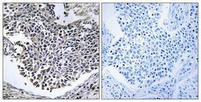 Antibody anti-ABHD9 100 µg