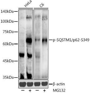 Western blot analysis of extracts of various cell lines, using Anti-SQSTM1 / p62 (phospho Ser349) Antibody (A305624) at 1:500 dilution