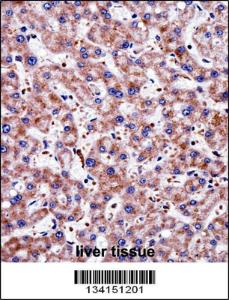 Anti-TAGLN2 Rabbit Polyclonal Antibody (Biotin)