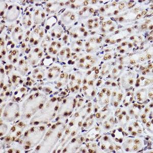 Immunohistochemistry analysis of paraffin-embedded mouse kidney using Anti-GTF2F2 Antibody [ARC2513] (A306881) at a dilution of 1:100 (40X lens). Perform high pressure antigen retrieval with 10 mM citrate buffer pH 6.0 before commencing with IHC staining protocol