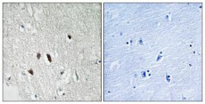 Immunohistochemical analysis of paraffin-embedded human brain tissue using Anti-RIPK2 Antibody. The right hand panel represents a negative control, where the antibody was pre-incubated with the immunising peptide