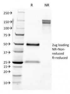 SDS-PAGE analysis of Anti-CD9 Antibody [CD9/1631] under non-reduced and reduced conditions; showing intact IgG and intact heavy and light chains, respectively. SDS-PAGE analysis confirms the integrity and purity of the antibody