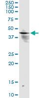 Anti-INPP1 Mouse Monoclonal Antibody [clone: 1A6]