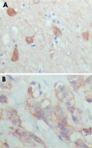 Anti-PAWR Mouse Monoclonal Antibody [clone: 3G9H7,4H12E9]