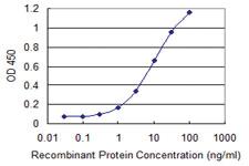 Anti-UGT1A6 Mouse Monoclonal Antibody [clone: 4A10]