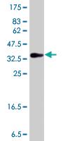 Anti-HECA Mouse Polyclonal Antibody