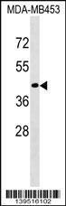 Anti-CD200R1L Rabbit Polyclonal Antibody (AP (Alkaline Phosphatase))