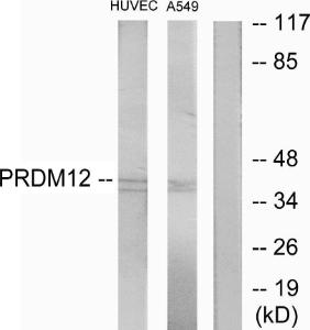 Western blot analysis of lysates from HUVEC and A549 cells using Anti-PRDM12 Antibody. The right hand lane represents a negative control, where the antibody is blocked by the immunising peptide.