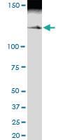 Anti-MYBBP1A Polyclonal Antibody Pair