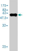 Anti-TPMT Mouse Monoclonal Antibody [clone: 1B5]