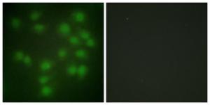 Immunofluorescence analysis of HUVEC cells using Anti-PTTG1 Antibody The right hand panel represents a negative control, where the antibody was pre-incubated with the immunising peptide