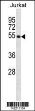 Anti-CREB3 Rabbit Polyclonal Antibody (HRP (Horseradish Peroxidase))