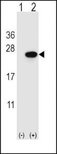 Anti-SAR1A Rabbit Polyclonal Antibody