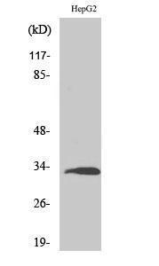 Anti-RPS3 antibody