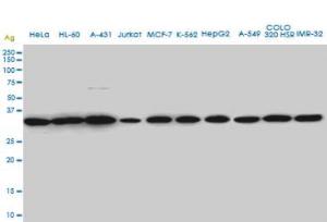 Anti-SUPT3H Mouse Monoclonal Antibody [clone: 1A6]