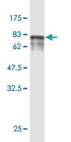 Anti-ENPP5 Mouse Monoclonal Antibody [clone: 1C5-1D7]