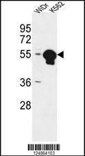 Anti-ATP6V1B1 Rabbit Polyclonal Antibody (APC (Allophycocyanin))