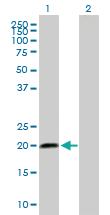 Anti-SCAND2P Mouse Polyclonal Antibody