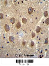 Anti-PCDHB3 Rabbit Polyclonal Antibody (HRP (Horseradish Peroxidase))