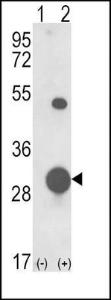 Anti-GSTM1 Rabbit Polyclonal Antibody (Biotin)