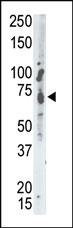 Anti-PTPN9 Rabbit Polyclonal Antibody