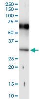 Anti-HOXB1 Polyclonal Antibody Pair