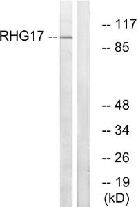 Western blot analysis of lysates from LOVO cells using Anti-RHG17 Antibody. The right hand lane represents a negative control, where the antibody is blocked by the immunising peptide.