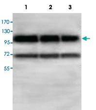 Anti-ABCF1 Rabbit Polyclonal Antibody