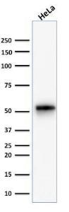 Western blot analysis of human HeLa cell lysate using Anti-Cytokeratin 7 Antibody [KRT7/1499R]