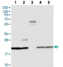 Anti-C9ORF40 Rabbit Polyclonal Antibody