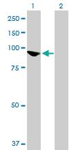 Anti-INPP5B Mouse Polyclonal Antibody