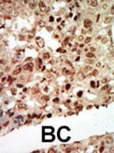 Anti-MAP Kinase p38, beta Rabbit Polyclonal Antibody (PE (Phycoerythrin))