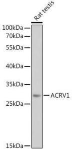 Western blot analysis of extracts of Rat testis, using Anti-ACRV1 Antibody (A12209) at 1:1,000 dilution. The secondary antibody was Goat Anti-Rabbit IgG H&L Antibody (HRP) at 1:10,000 dilution.