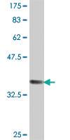 Anti-VPS29 Mouse Polyclonal Antibody