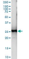 Anti-KLRG1 Polyclonal Antibody Pair