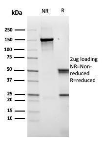 SDS-PAGE analysis of Anti-CD14 Antibody [rLPSR/2408] under non-reduced and reduced conditions; showing intact IgG and intact heavy and light chains, respectively. SDS-PAGE analysis confirms the integrity and purity of the antibody.