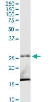 Anti-C8ORF33 Rabbit Polyclonal Antibody