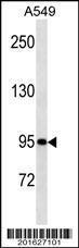 Anti-TLE1 Mouse Monoclonal Antibody [clone: 381CT18.5.1]