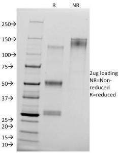 SDS-PAGE analysis of Anti-delta 1 Catenin Antibody [25a] under non-reduced and reduced conditions; showing intact IgG and intact heavy and light chains, respectively SDS-PAGE analysis confirms the integrity and purity of the antibody